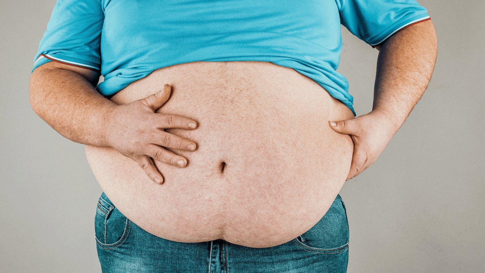 Conheça o tratamento para obesidade em Passo Fundo com o Dr. Cristiano Noskoski e descubra um novo caminho para sua saúde.